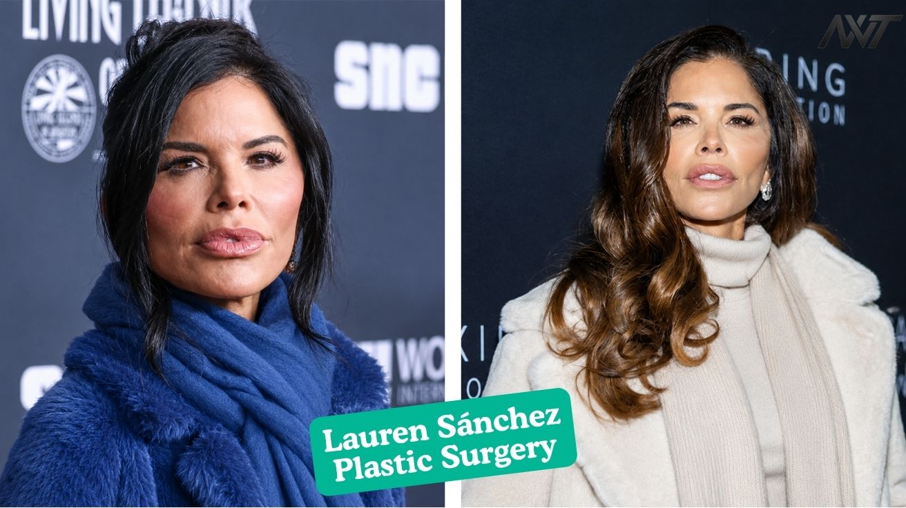 Lauren Sánchez Plastic Surgery Her Transformation Rumors, Net Worth, and Personal Life